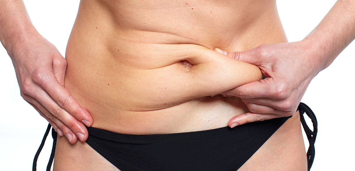 gordura localizada na barriga